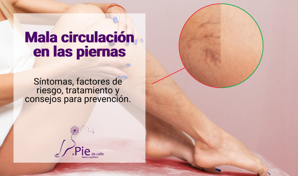 Causas De La Mala Circulación Sanguínea